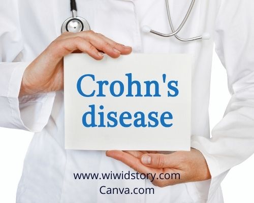 Gejala Penyakit Crohn